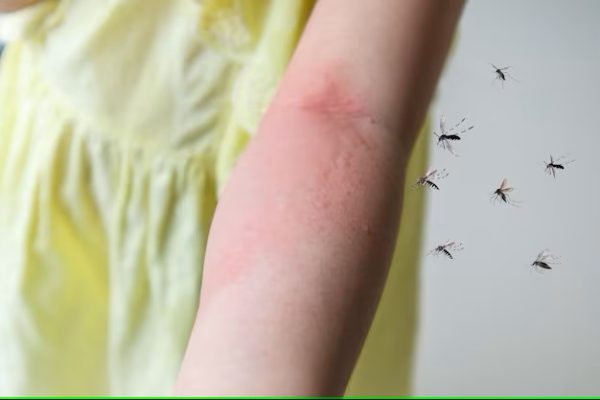 Understanding Mosquito
